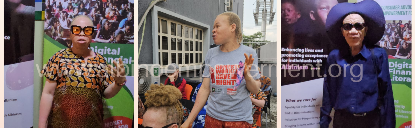 Albino Empowerment Foundation BEYOND PITY campaign and AEF Albinism Support Group in Lagos